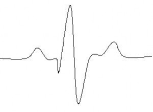 A heartbeat Diagram of a heartbeat, to show how it can be used as a metaphor for finding balance